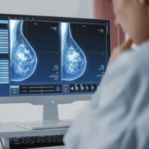 Mulheres de Aracruz terão acesso a cerca de mil exames com Carreta da Ultrassonografia